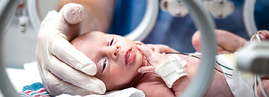 A hand in a surgical glove softly cradles a premature infant's head in the nicu